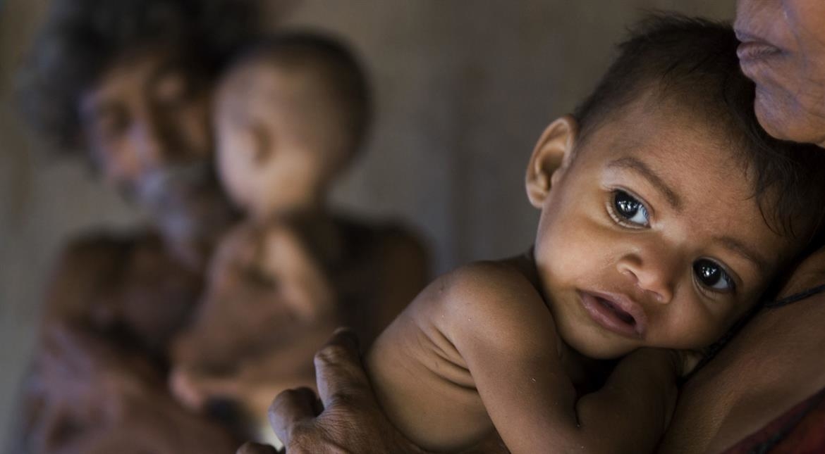 how malnutrition is choking