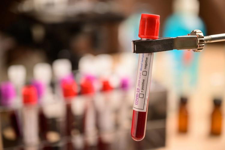 COVID-19: Kerala Gets ICMR Nod for Plasma Therapy | NewsClick