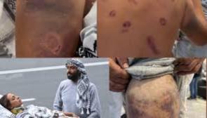 Gaza Global Sumud Flotilla activists arrived in Turkey in horrific condition after severe beatings in Israeli custody. Photo: State of Palestine