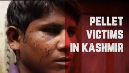 Pellet injuries Kashmir