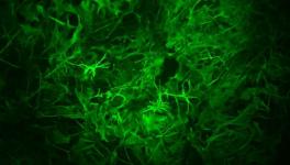 Long -term Memory Involves