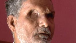 Patel Shah, 60 The Bhagalpur resident was blinded in October 1980 allegedly by the police. Shah had later alleged that then SP V D Ram was present when a mob and policemen punctured his eyes with a bicycle spoke and injected acid into his eyes. 