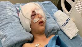 Malek Issa is battling life threatening injuries at at the Hadassah medical center in al-Issawiya.