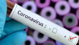 Number of Coronavirus Positive Cases Rise to 84: Health Ministry
