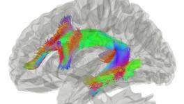 How Old Is Origin of Language in Human Brain?