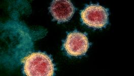 SARS-like Viruses in Animals Infect 4,00,00 Humans Every Year: Study