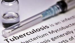 Diagnosis and Recovery Long, Expensive for Multidrug-Resistant TB Patients, Reveals Study