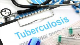 COVID-19: Over 5 Lakh People in India Missed or Delayed TB Diagnosis in 2020
