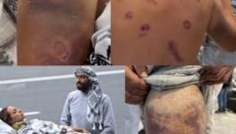 Gaza Global Sumud Flotilla activists arrived in Turkey in horrific condition after severe beatings in Israeli custody. Photo: State of Palestine