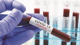 COVID-19 and Some of the Significant Research Findings