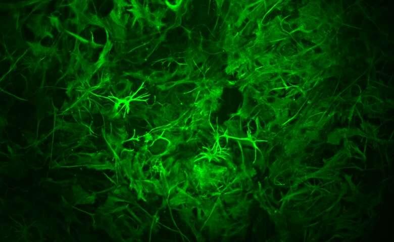 Long -term Memory Involves