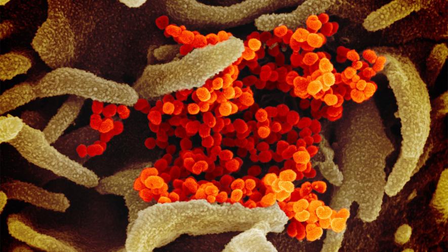 Posts on social media and even a scientific paper have suggested the coronavirus that causes COVID-19—seen here in orange, emerging from a cell—originated in a virology lab in Wuhan, China. 