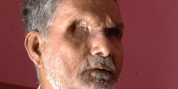 Patel Shah, 60 The Bhagalpur resident was blinded in October 1980 allegedly by the police. Shah had later alleged that then SP V D Ram was present when a mob and policemen punctured his eyes with a bicycle spoke and injected acid into his eyes. 