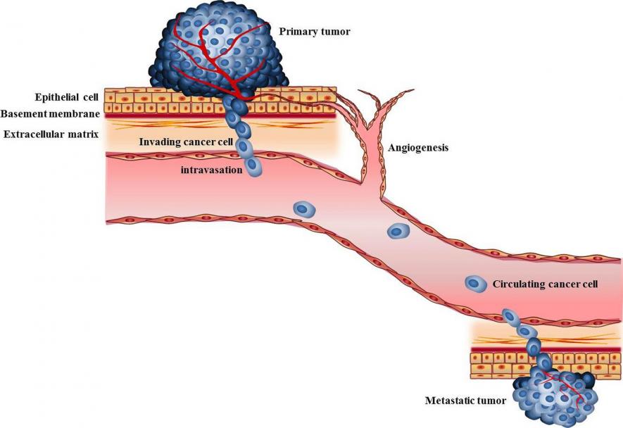 How Spread of Cancer Is Related to Genetics