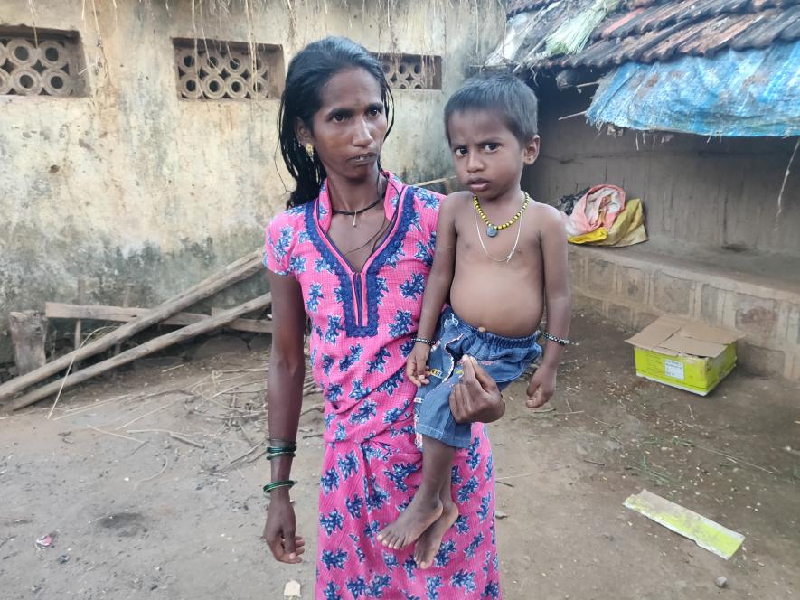 Gulab govind with her Malnourished son Akash