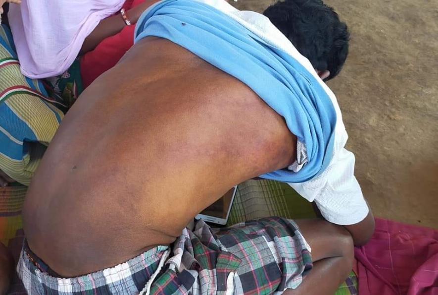 40 Tribal Christians Assaulted in front of Church in Chhattisgarh; Police Deny Religious Conflict