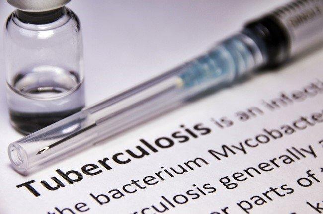 Diagnosis and Recovery Long, Expensive for Multidrug-Resistant TB Patients, Reveals Study