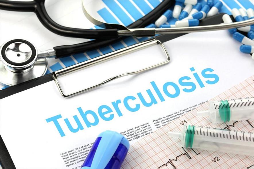 COVID-19: Over 5 Lakh People in India Missed or Delayed TB Diagnosis in 2020