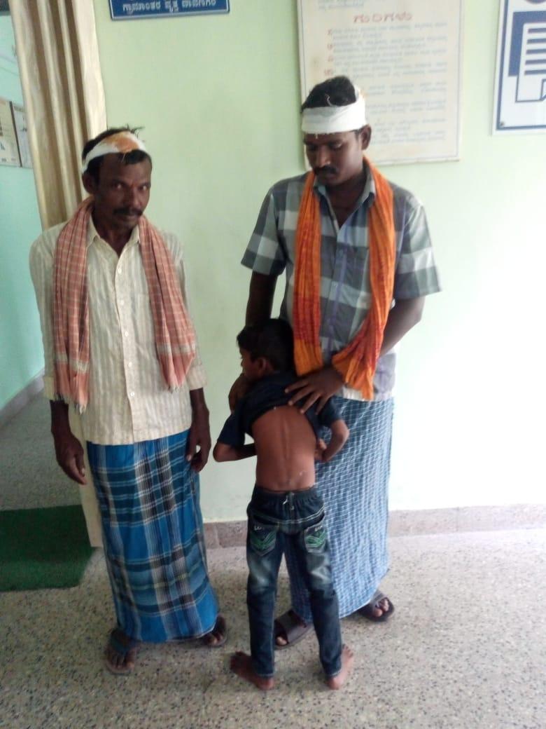 Ajay, Six year old boy, beaten up by cycle chains